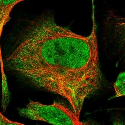 R3HDM4 Antibody, Novus Biologicals 25 &mu;L, Unlabeled:Antibodies, Polyclonal